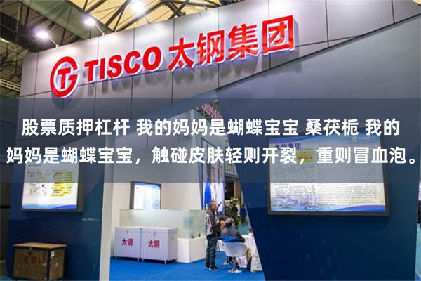 股票质押杠杆 我的妈妈是蝴蝶宝宝 桑茯栀 我的妈妈是蝴蝶宝宝，触碰皮肤轻则开裂，重则冒血泡。